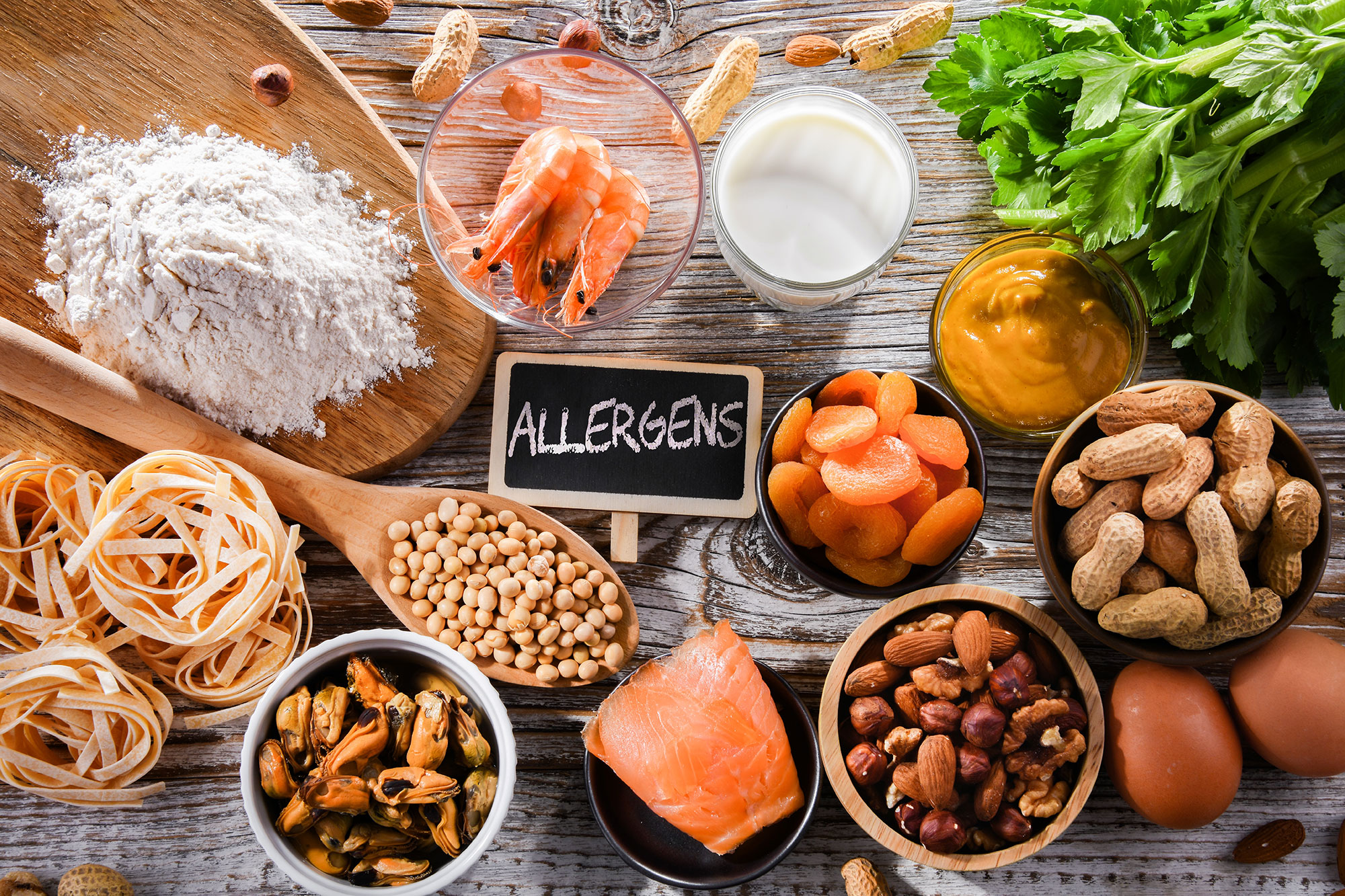 Avoiding Allergen Cross-Contact at Events